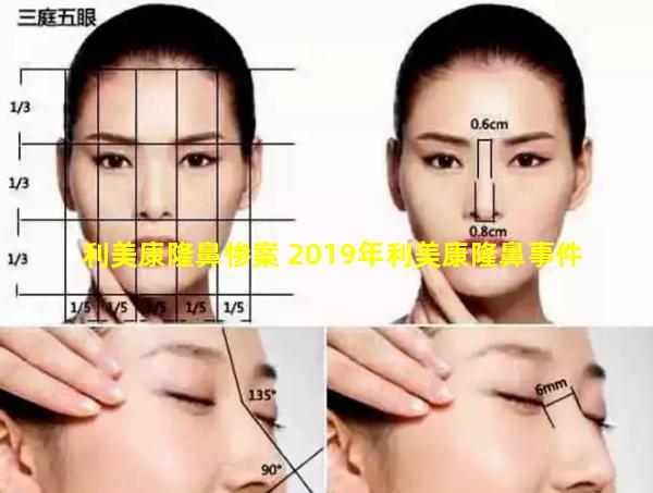 利美康隆鼻惨案 2019年利美康隆鼻事件